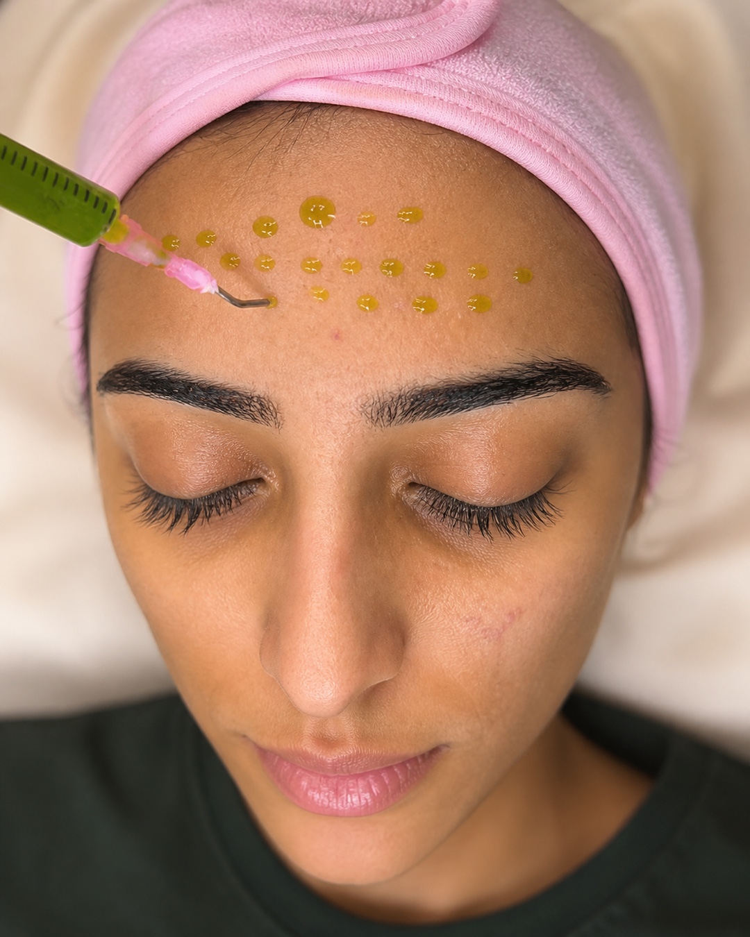 Client receiving a professional BioRePeel treatment at LA Skin Spa