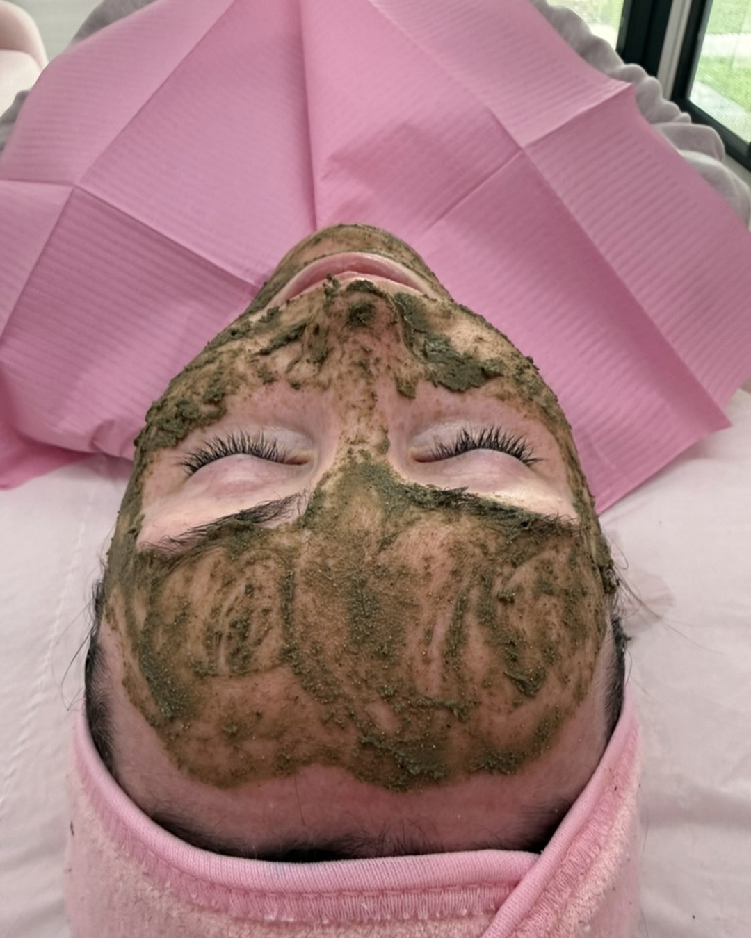 Client receiving a professional Décaar Algae Peel treatment at LA Skin Spa